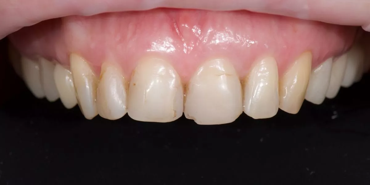 Фото до процедуры