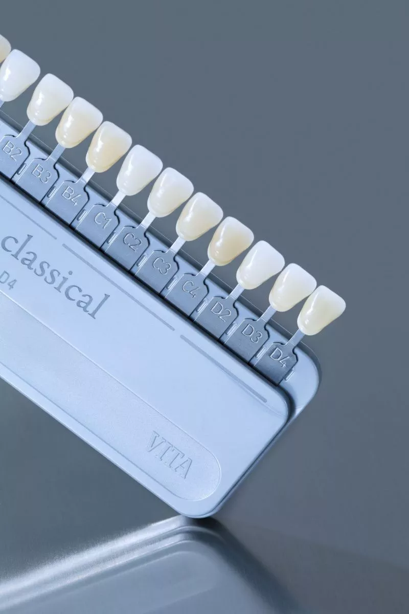 Замена керамических виниров и коронок