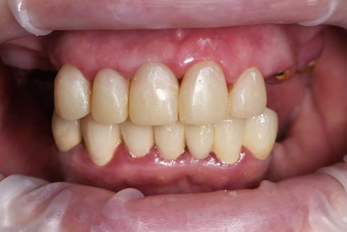 Фото до процедуры