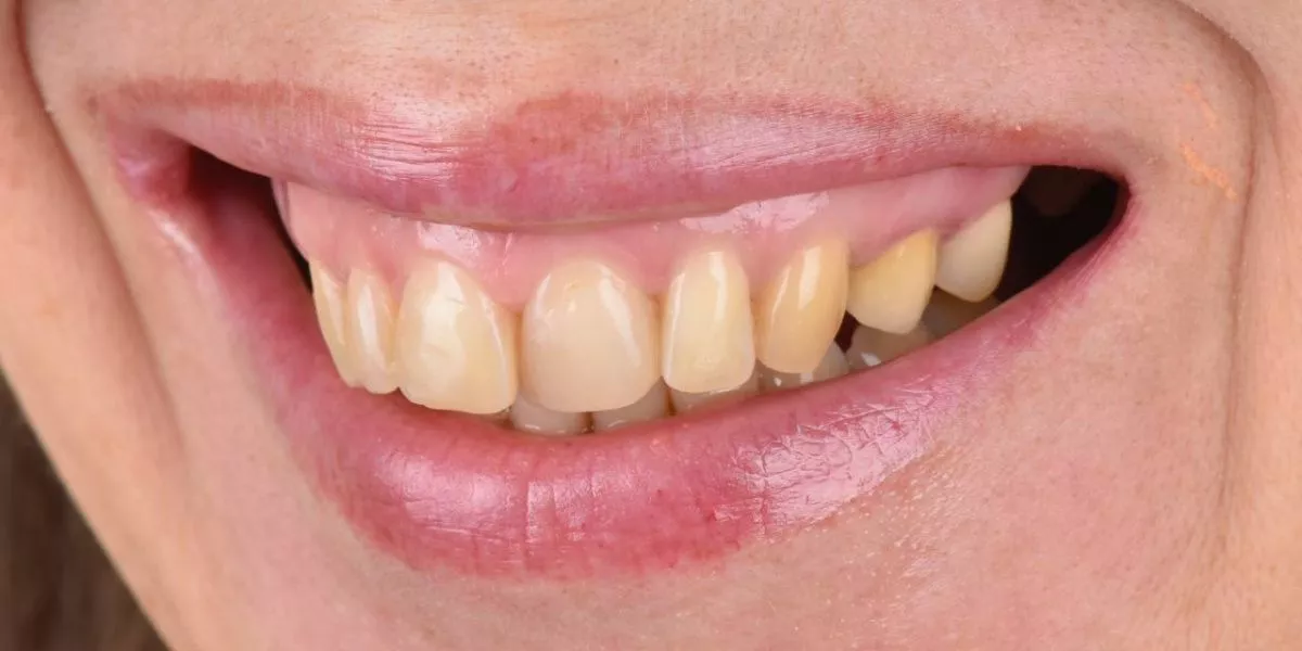 Фото до процедуры