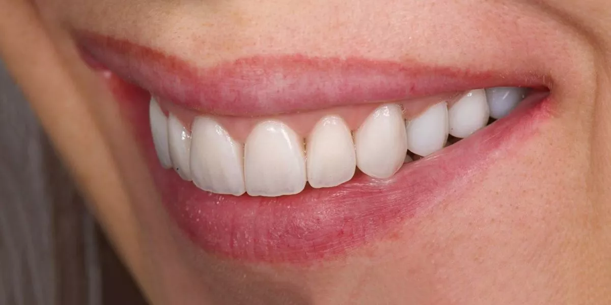 Фото после процедуры