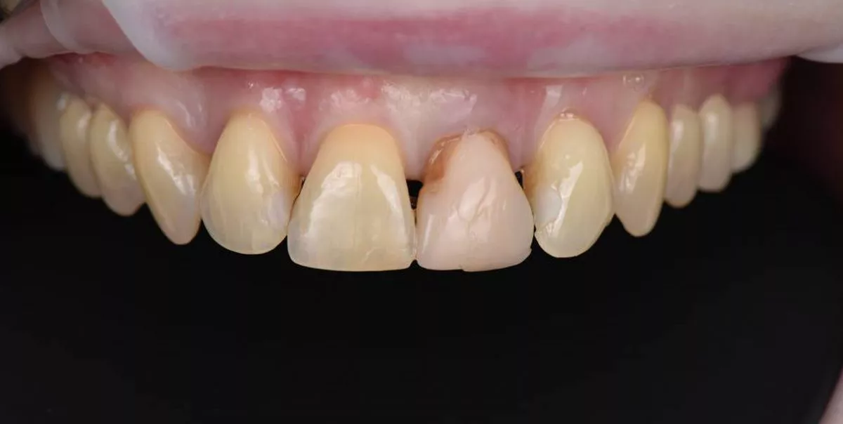 Фото до процедуры