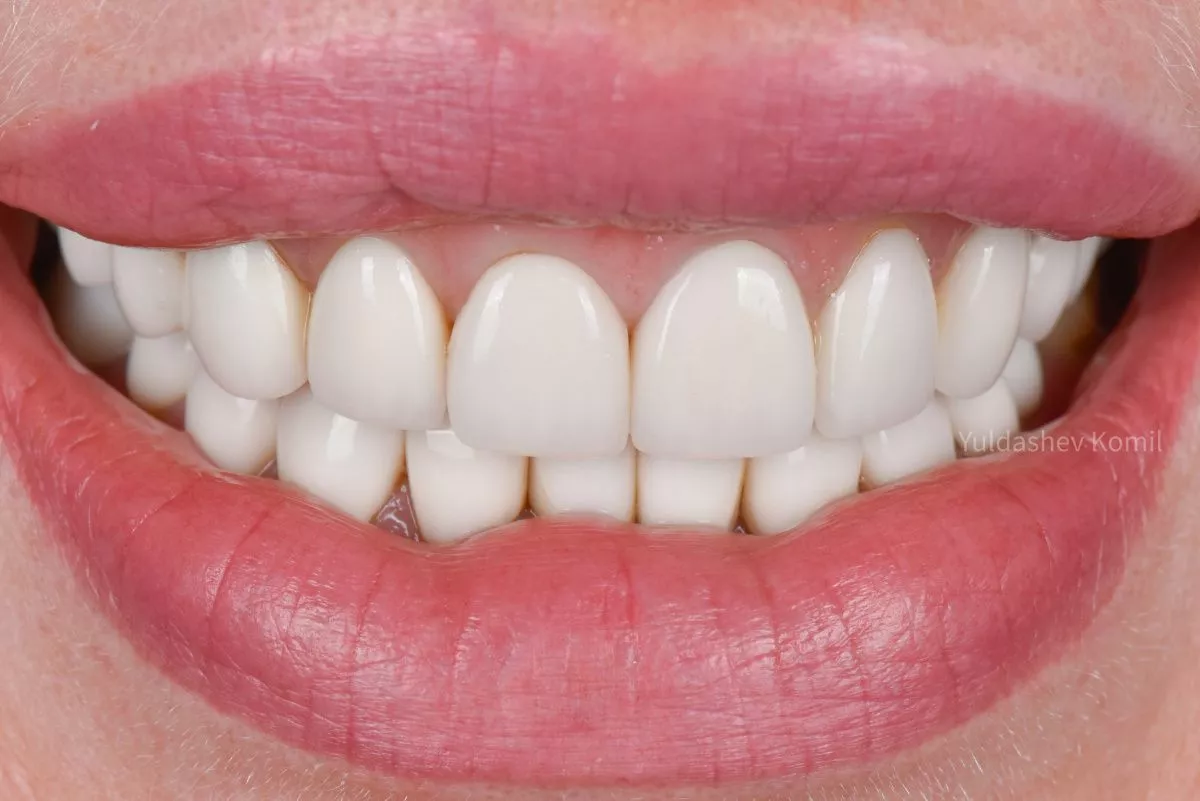 Фото до процедуры