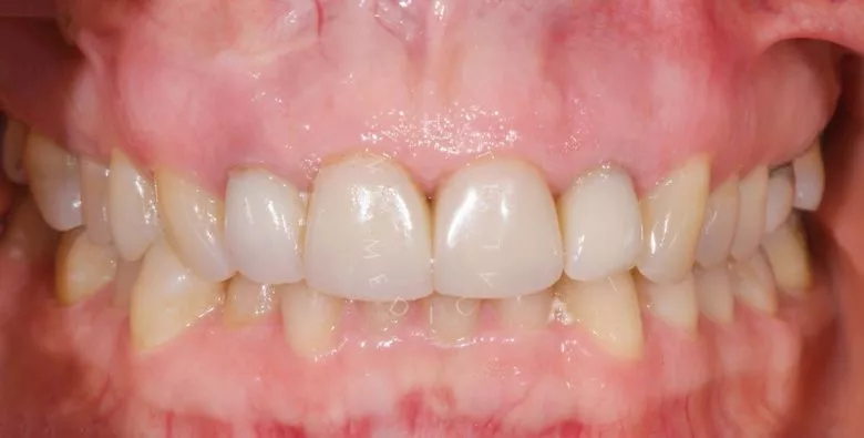 Фото до процедуры