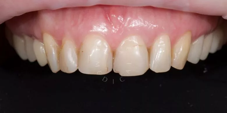 Фото до процедуры