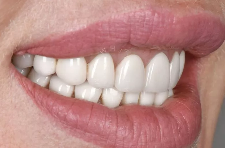 Фото до процедуры