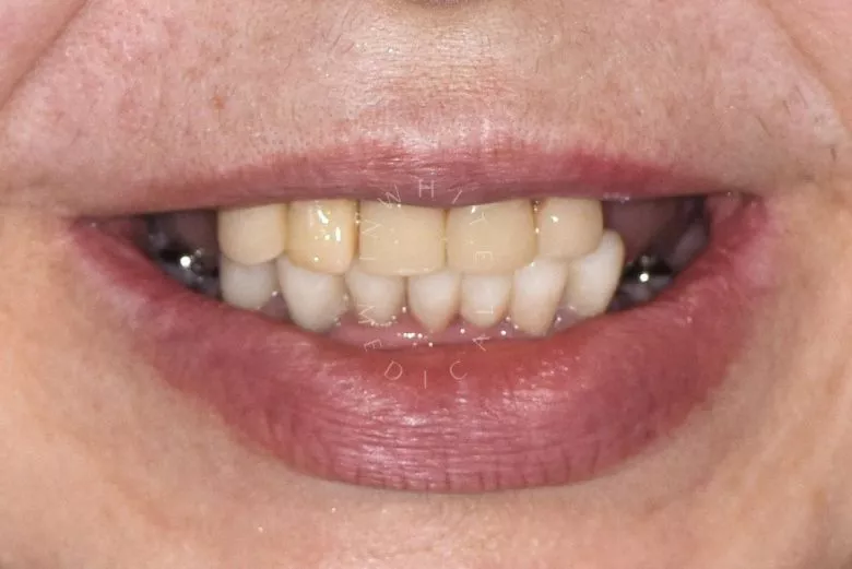 Фото до процедуры