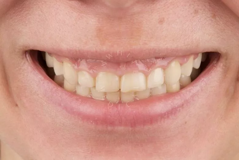 Фото до процедуры