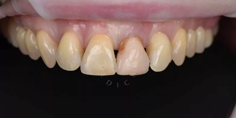 Фото до процедуры