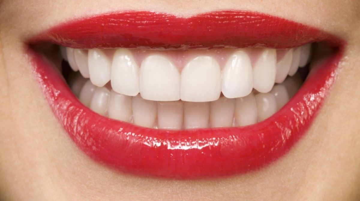 Пластика уздечки верхней и нижней губы, уздечки языка