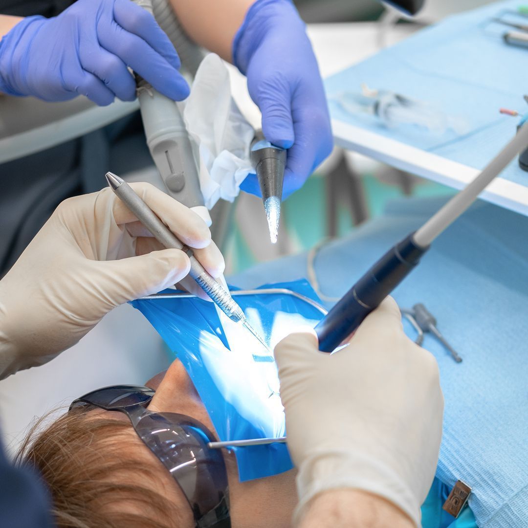 Восстановление зуба временной коронкой