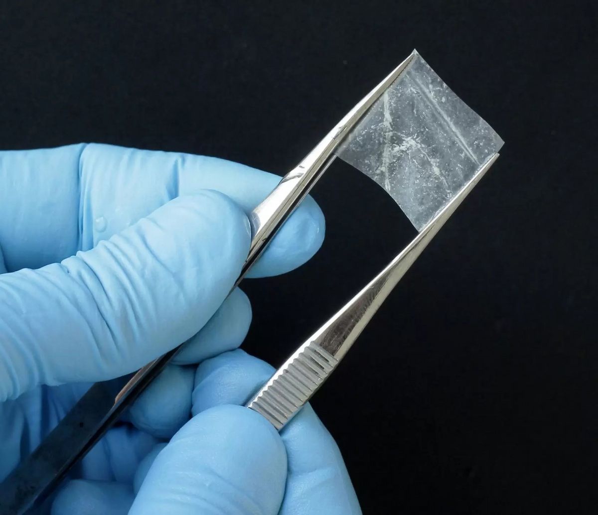 Пластика мягких тканей