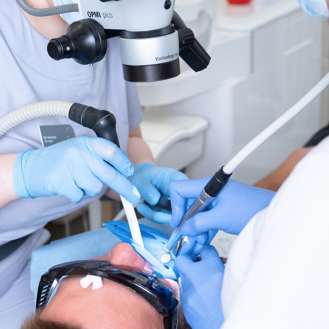 Закрытие перфорации стенки корневого канала