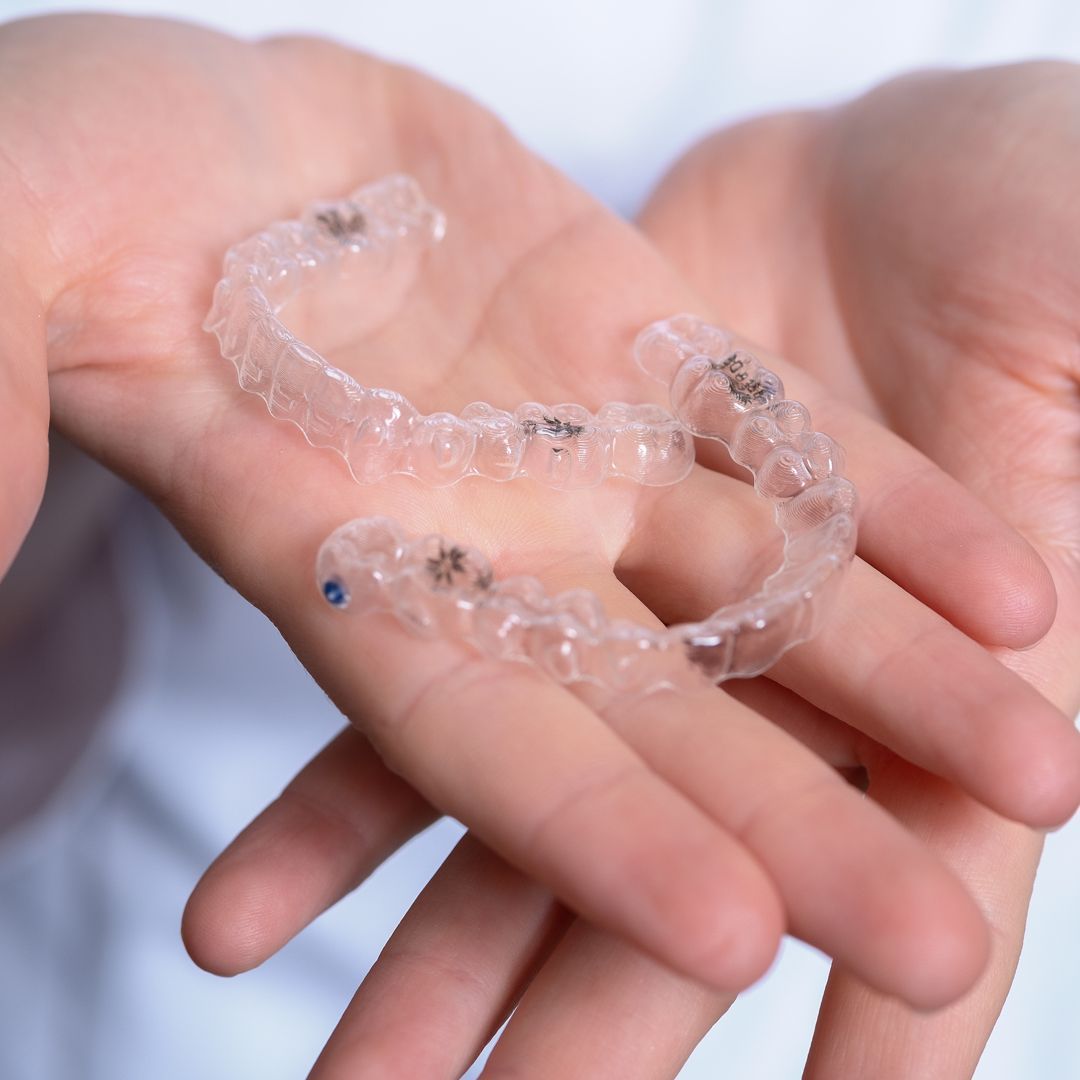 Лечение на системе элайнеров