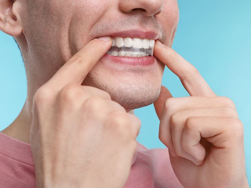 Как ухаживать за коронками?